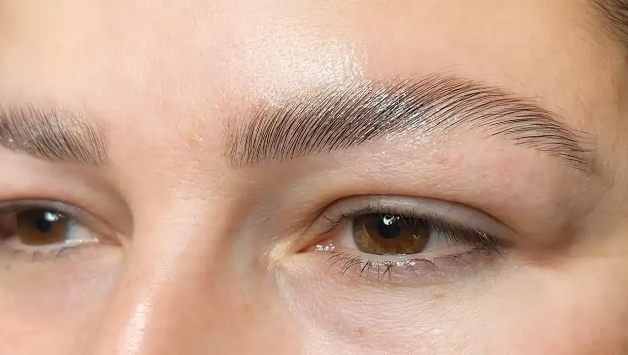 laminace_browlift_after